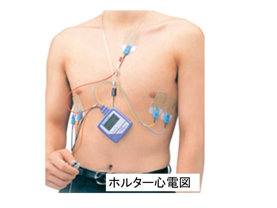 ホルター心電図