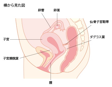 子宮内膜症　横からの図