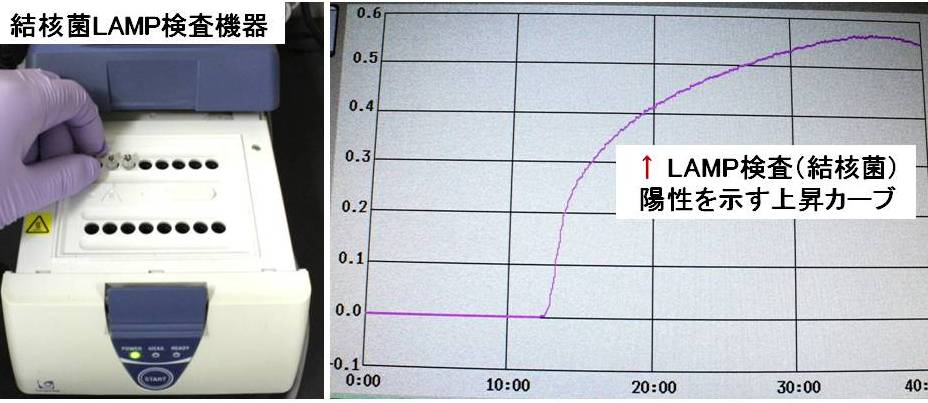 結核菌（LAMP)検査