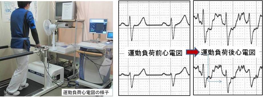 負荷心電図