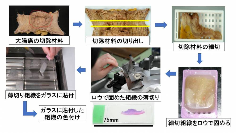 病理検査（標本作製）