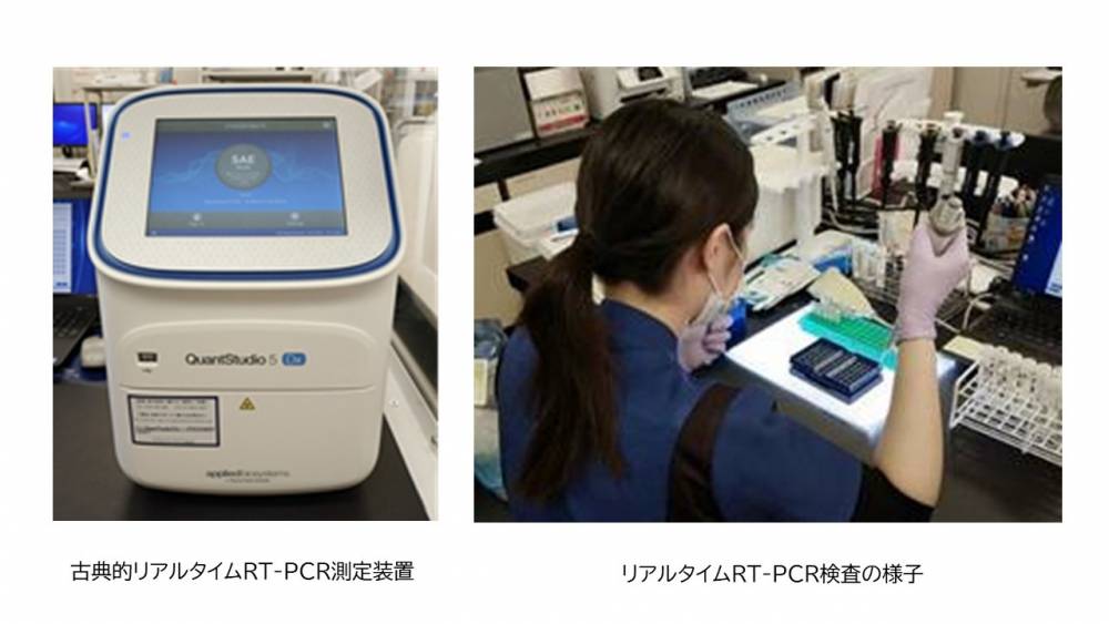 RT-PCR検査