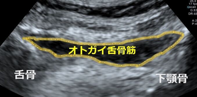 データ