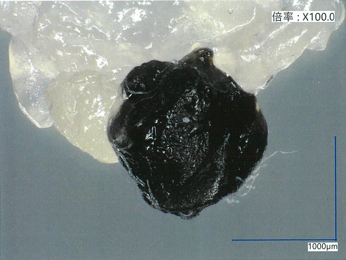混入した異物(拡大)