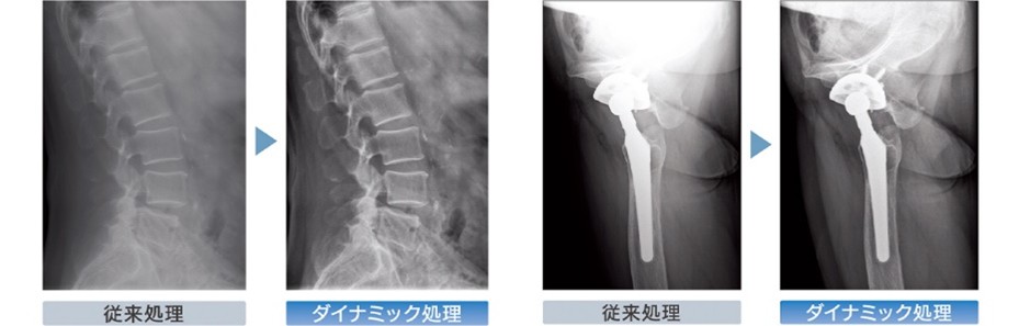 ダイナミック処理