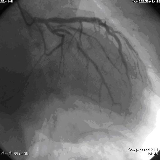 心臓・冠動脈撮影像